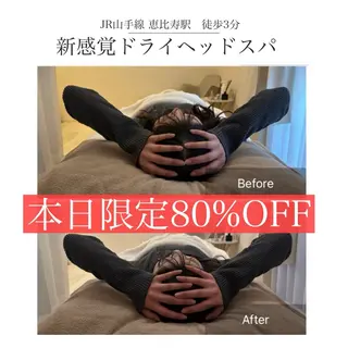 メンズ 新感覚マシン× ドライヘッドのエステ・リラクイメージ