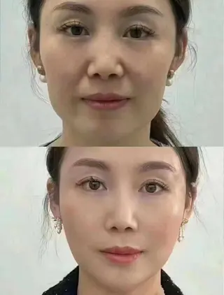 ネイル 愛維美水光専門店 川崎彩鳳のエステ・リラクイメージ