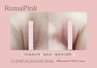 たるみほうれい線ケア 看護師サロンのエステ・リラクイメージ