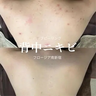 MI SUZUのエステ・リラクイメージ