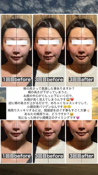 💎後悔させない小顔 矯正💎イトヤマ🌱のエステ・リラクイメージ