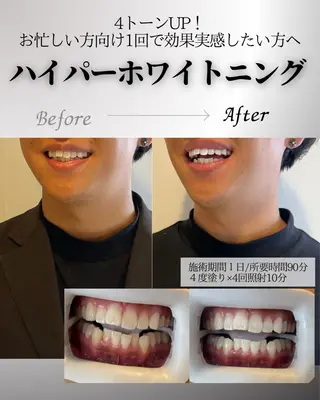 歯科提携エラン ホワイトニング一社店のその他イメージ