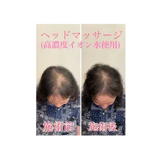 町田・鶴川 小顔矯正 /鈴木友実のエステ・リラクイメージ