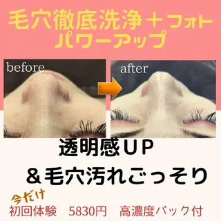 美肌を叶えるサロン ihanaのエステ・リラクイメージ