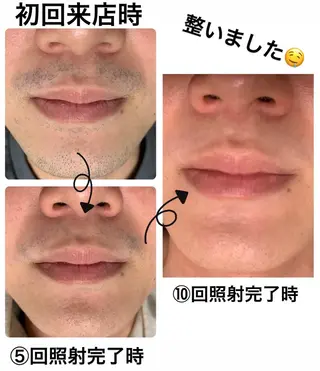 メンズ脱毛サロン Le falcoのエステ・リラクイメージ