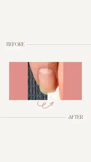 ネイル fote-自爪育成 ネイルケアサロン-のネイルデザイン