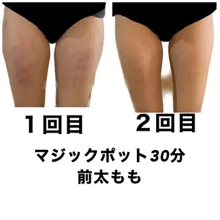 ネイル・エステサロン UILANIのエステ・リラクイメージ