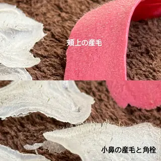 ワックス脱毛/光脱毛 🎀新宿駅徒歩5分のエステ・リラクイメージ