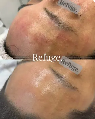 Refuge. （リフュージュ）のエステ・リラクイメージ