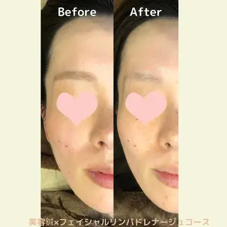 鍼灸サロン Sakuraのエステ・リラクイメージ