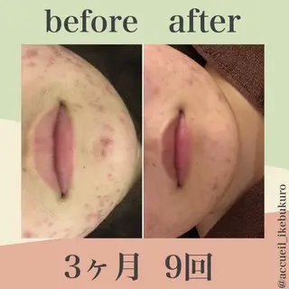 ミディアム カラー パーマ ヘアアレンジ メンズ キッズ ネイル マツエク・マツパ ニキビ・肌質改善専門 ♡人生が変わるサロンのエステ・リラクイメージ
