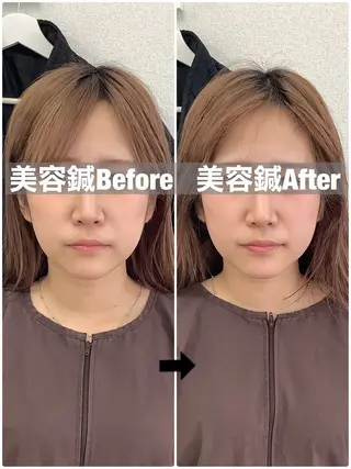 ハリサロンドオフ 美容鍼灸×小顔整体のエステ・リラクイメージ