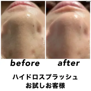 ネイル・エステサロン UILANIのエステ・リラクイメージ