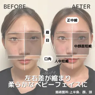 小顔矯正/骨格矯正 AKANEのエステ・リラクイメージ