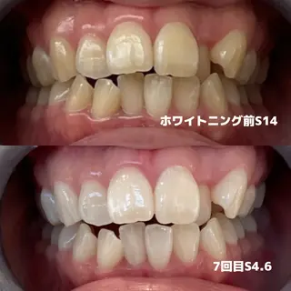 Whitening Beauty 行橋店のその他イメージ