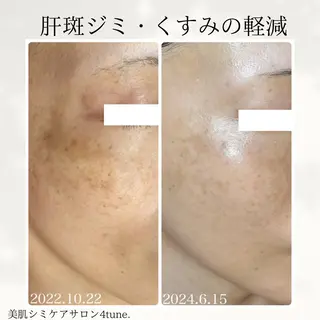 美肌シミケアサロン 4tune.RUMIのその他イメージ