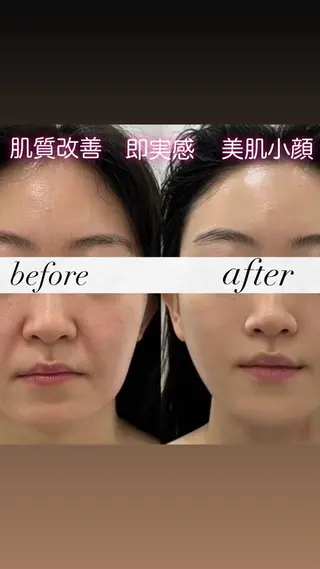 マツエク・マツパ 愛維美水光美肌専門店 メンズレディースokのエステ・リラクイメージ