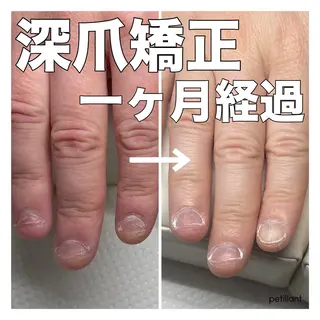 ネイル nail salon petillantのネイルデザイン
