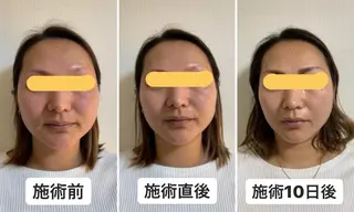 岡本 千穂のマツエク・マツパデザイン