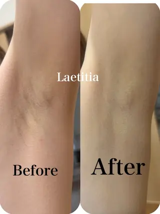 レティティア (Laetitia)のエステ・リラクイメージ