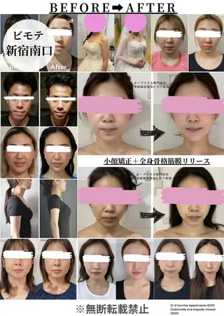 骨格美容整体 bimote.新宿のエステ・リラクイメージ