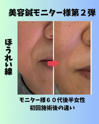 あおぞら 鍼灸整骨院のエステ・リラクイメージ