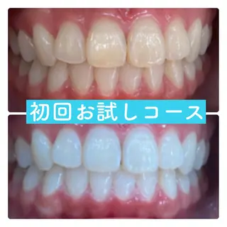 ホワイトニングルーム 横浜店のその他イメージ