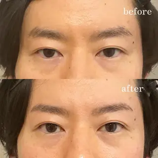 メンズ アイブロウ 銀座ACE 水川の眉毛・アイブロウイメージ