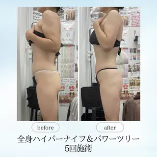 《痩身、小顔専門店》 エスプレッソのエステ・リラクイメージ
