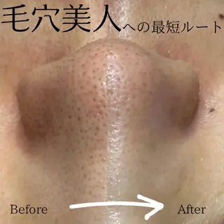 🌷MURA 毛穴・顔脱毛🌷のエステ・リラクイメージ
