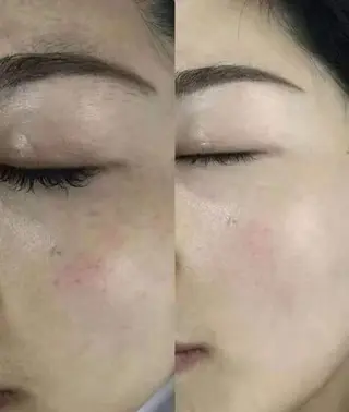 マツエク・マツパ 愛維美水光専門店 川崎彩鳳のエステ・リラクイメージ