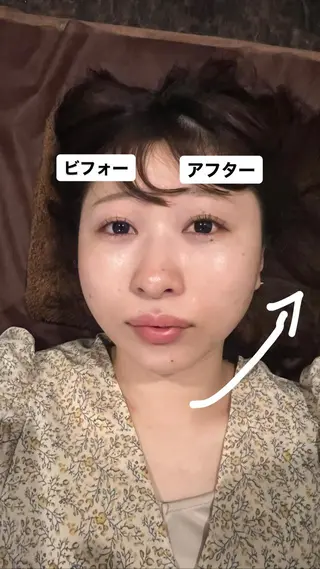 メンズ 美容鍼灸サロン LOMIHARIのエステ・リラクイメージ
