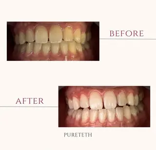 ホワイトニングサロン PURETETHのエステ・リラクイメージ