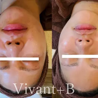 Vivant+B ゆりのエステ・リラクイメージ