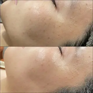 LiZA エステティックサロンのエステ・リラクイメージ