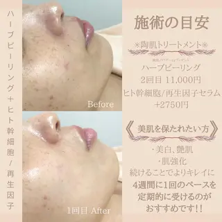 ショート カラー パーマ ヘアアレンジ メンズ キッズ ネイル マツエク・マツパ アイブロウ アイブロウサロン muni 福島区野田の眉毛・アイブロウイメージ