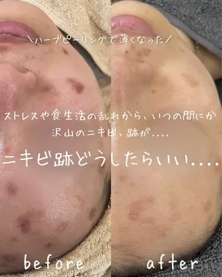 miki 東根の肌質改善サロンのエステ・リラクイメージ