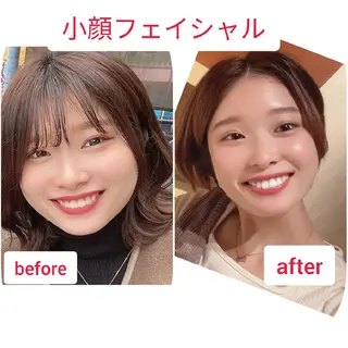 小顔&たるみアップ 専門店リラーシェのエステ・リラクイメージ