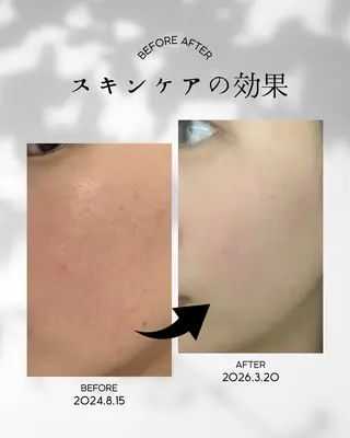 エステWAM 髙木のエステ・リラクイメージ