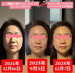 メンズ ハイパーナイフ専門 熊田陽子のエステ・リラクイメージ