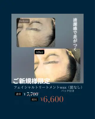 メンズ 脱毛 yukinoのエステ・リラクイメージ