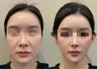 愛維美水光美肌専門店 メンズレディースokのエステ・リラクイメージ
