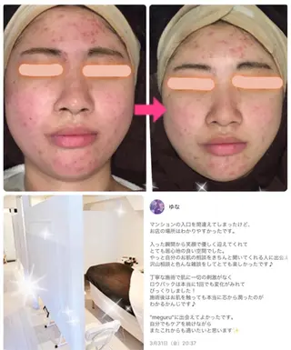 ショート カラー パーマ ヘアアレンジ メンズ キッズ ネイル マツエク・マツパ 痩身&ボディ 結果出し🌟丹野のエステ・リラクイメージ