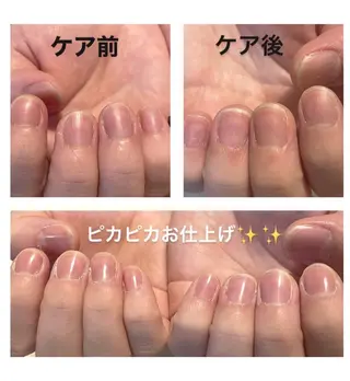 ネイル ネイルサロン A-nailのネイルデザイン