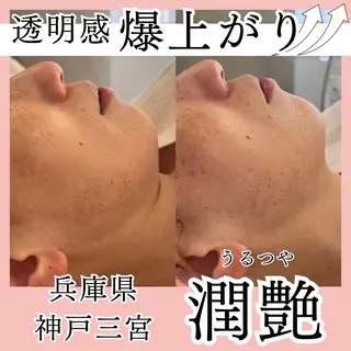 小尻・太もも痩せる パルタージュのエステ・リラクイメージ