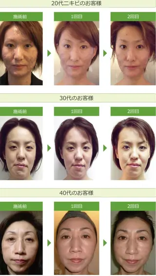 ハーブピーリング専門 店⭐︎AI.HERBのエステ・リラクイメージ