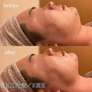 磐田|LAYLA 一番丁寧な脱毛店のエステ・リラクイメージ