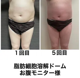 ネイル・エステサロン UILANIのエステ・リラクイメージ
