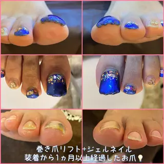 ネイル ♢ME2ROOM♢ #巻き爪#リラクのネイルデザイン