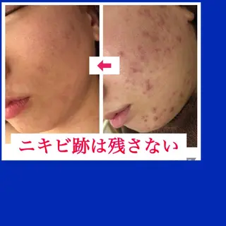 ミディアム カラー パーマ ヘアアレンジ メンズ キッズ ネイル マツエク・マツパ 金の糸脱毛 産毛ケア専門のエステ・リラクイメージ